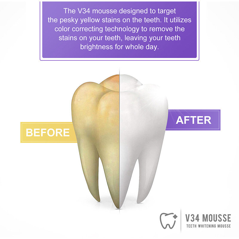 Smilekit V34 pasta gigi ungu korektor warna gigi membersihkan rongga mulut tetap menyegarkan pengurang noda kuning produk pemutih