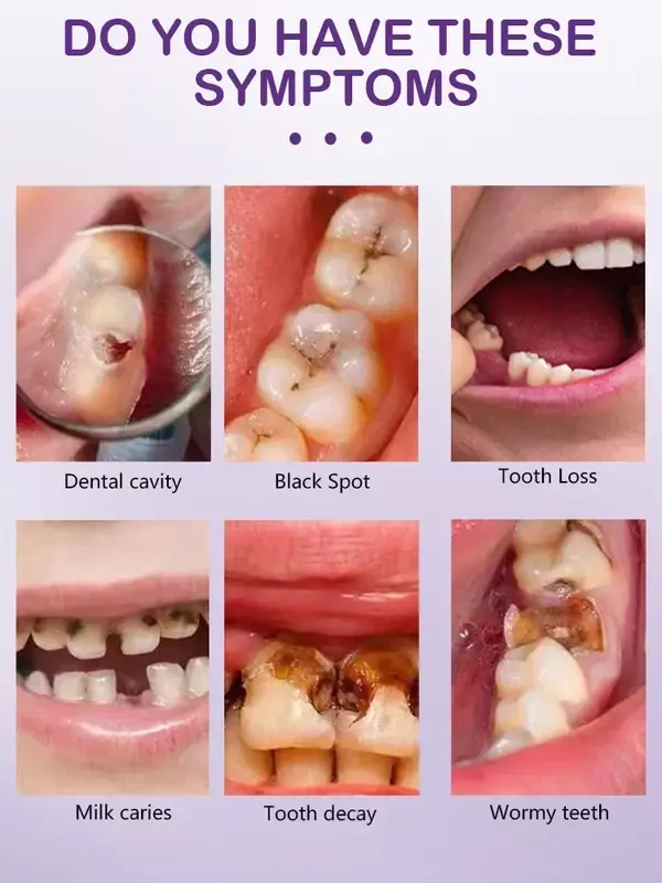 Blanchiment des dents professionnel, anti-carie, carie, réparation de la mauvaise haleine fraîche, élimination de la plaque dentaire, maux de dents, parodontite