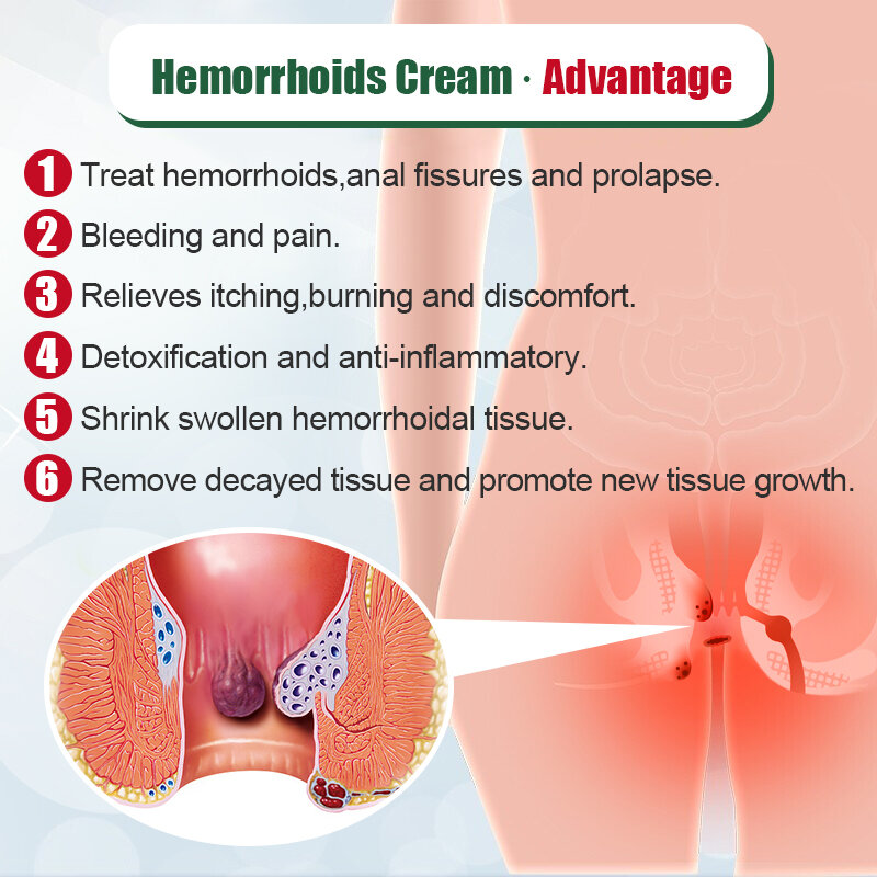 1Pcs Chinese Medical Hemorrhoids Ointment Relief Anal Pain Swell Bleed Treat Anal Fissure Internal And External Piles Cream S051
