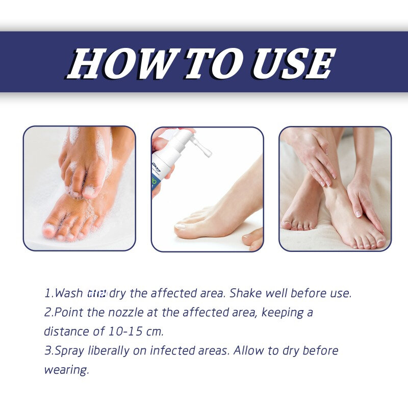 Hongo Debacteria tratamiento en aerosol para pies Beriberi, peeling seco, olor de los pies, ulceración, inhibe el pie de atleta, crema antipicazón para el cuidado