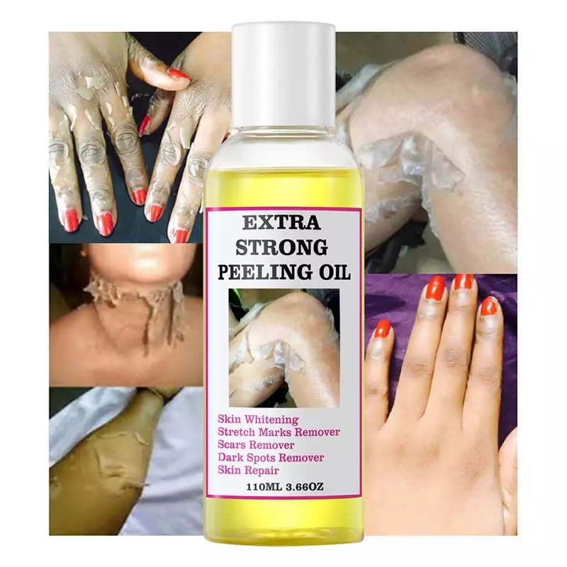 Aceite Peeling amarillo Extra fuerte, 110ml, aceite blanqueador, aclara los codos, las rodillas, las manos, melanina, incluso el tono de la piel y blanquea la piel
