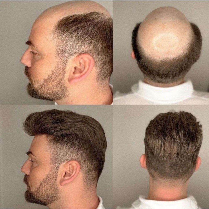 男性用の人間の髪の毛のトーピー,天然のヘアライン,ヨーロッパのピアウィッグ,交換システム