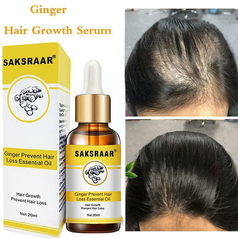 Saksraar-aceite esencial de jengibre para el crecimiento rápido del cabello, aceite de champú denso para prevenir la caída del cabello, X7D9