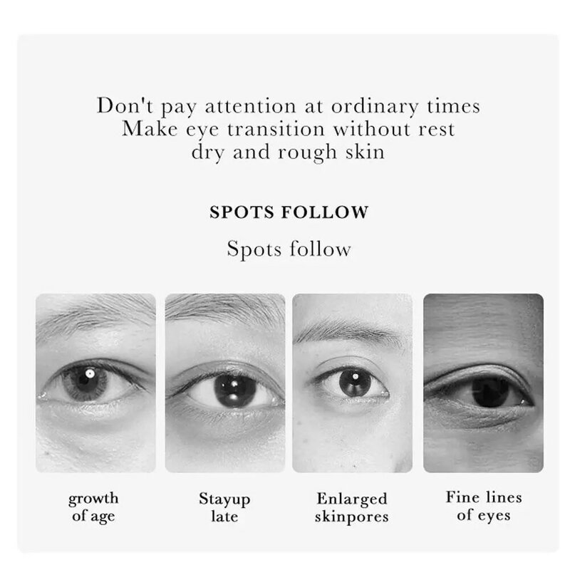Rimuovi le occhiaie crema per gli occhi antirughe dissolvenza Fine idratante gonfiore cura linee secche borse per la pelle alleviare J3W0