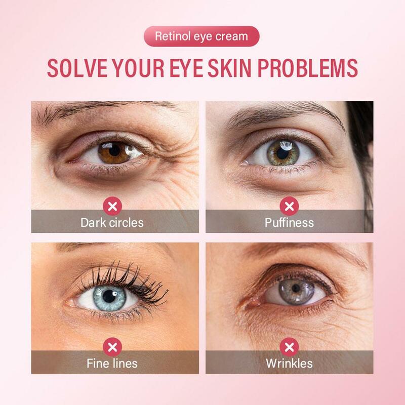 Crema antiarrugas de Retinol para los ojos, elimina las bolsas de los ojos, las ojeras, antienvejecimiento, Lifting, reafirmante, blanqueador, hidratante, ilumina el cuidado de la piel