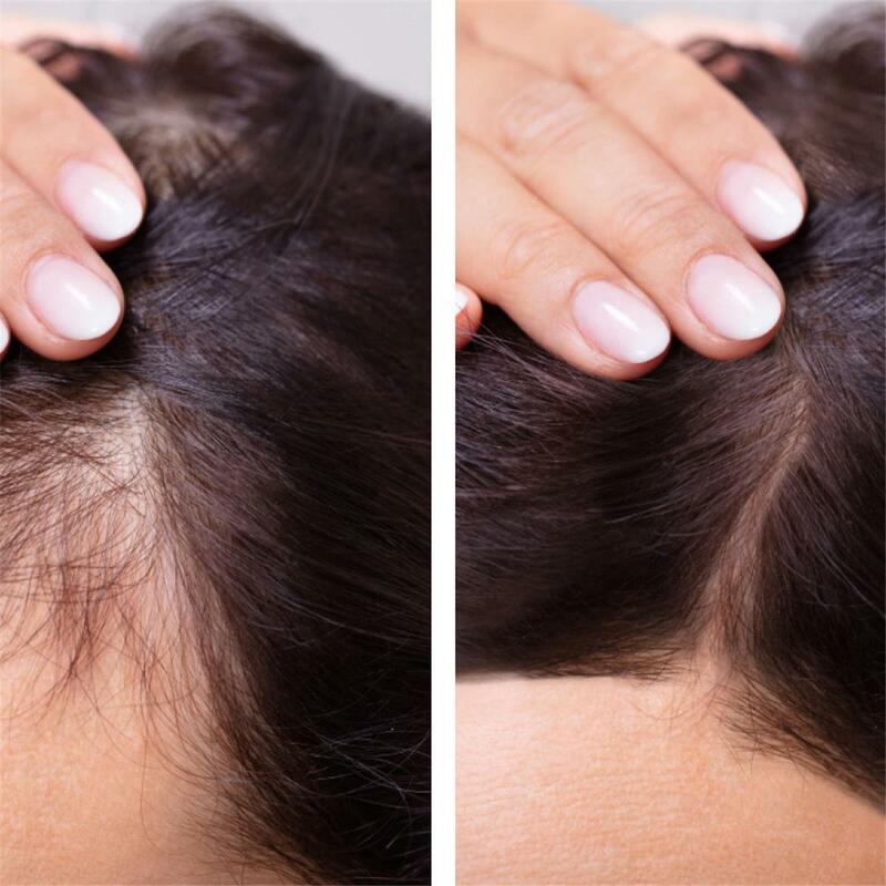 Haarwuchs Serum Anti verhindert Haarausfall Alopezie flüssig geschädigte Haar reparatur wächst schneller