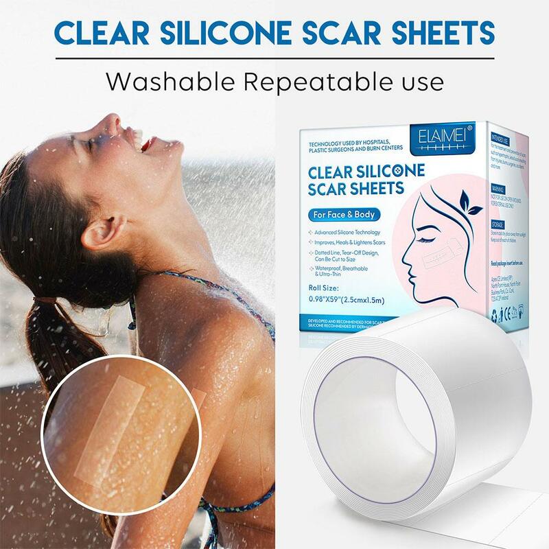 150cm Silicone Gel Scar Sheet Patch Treatment Removal Beauty Section Ear Acne Skin Cover Repair Tape Burn Trauma Scar U3I1