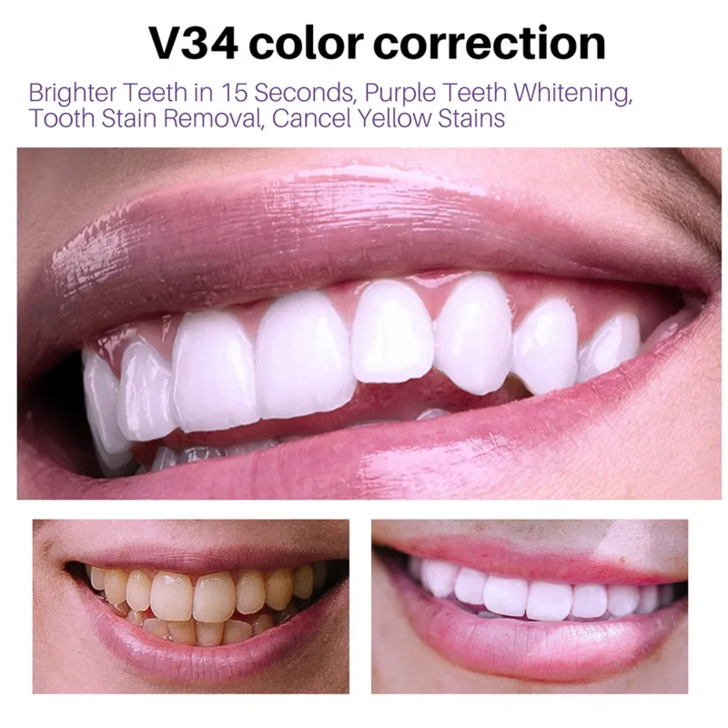 V34 무스 치아 청소 치약, 효과적인 치아 청소 미백 치약, 노란색 감소 치아 얼룩 구강 제거, 30ml