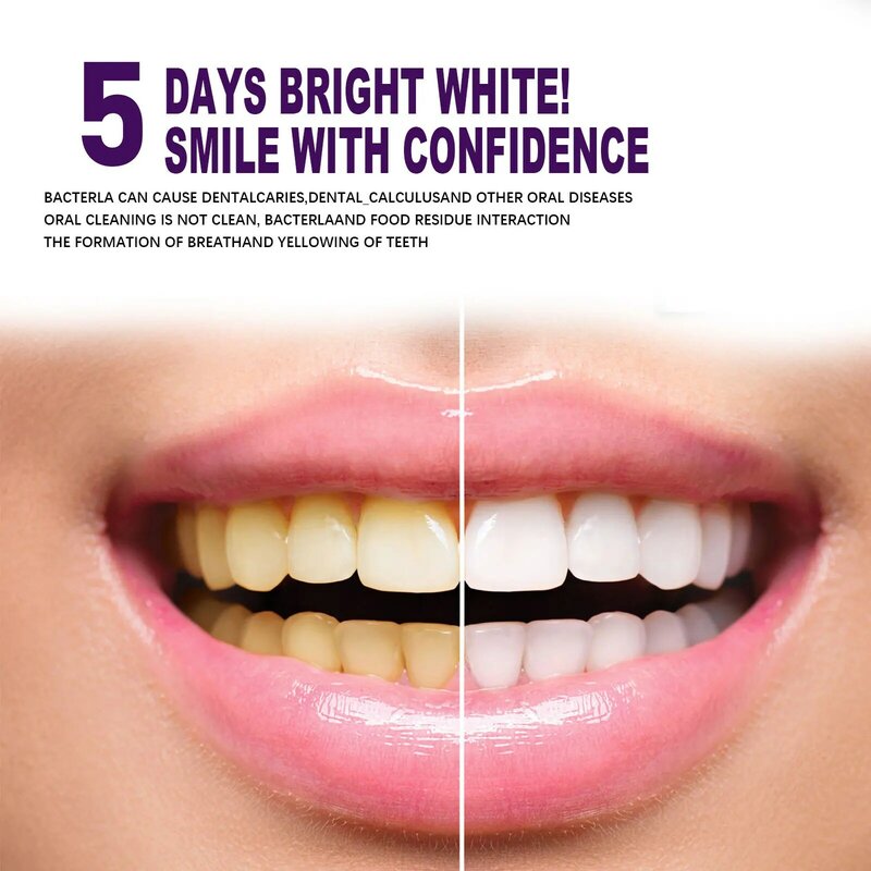 V34 Purple Whitening Toothpaste Cleans Mouth Fresh Breath Remove Yellow Stains Protect Teeth White Decontamination Care 2024