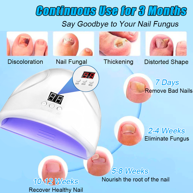 Dispositivo láser para uñas fungicida, reparación rápida de hongos, onicomicosis, uñas de los pies, elimina hongos en las uñas, cuidado de los pies, cura encarnada