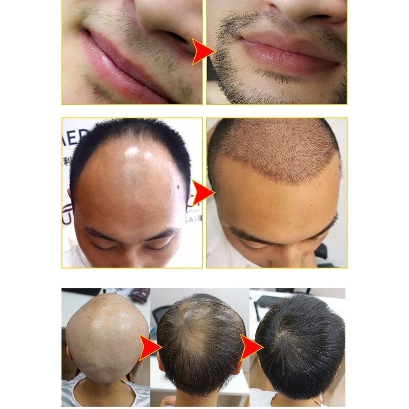 Y1UF 30 мл Спрей для роста бороды Эффективный спрей для ухода за бородой Идеально подходит для ежедневного использования