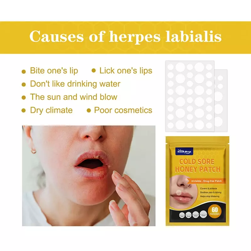 Cold Sore Honey Patch, Remover a boca Ultravioleta Blisters Herpes Adesivo, Infecção fúngica, Gesso Médico para Alívio da Dor, 240pcs
