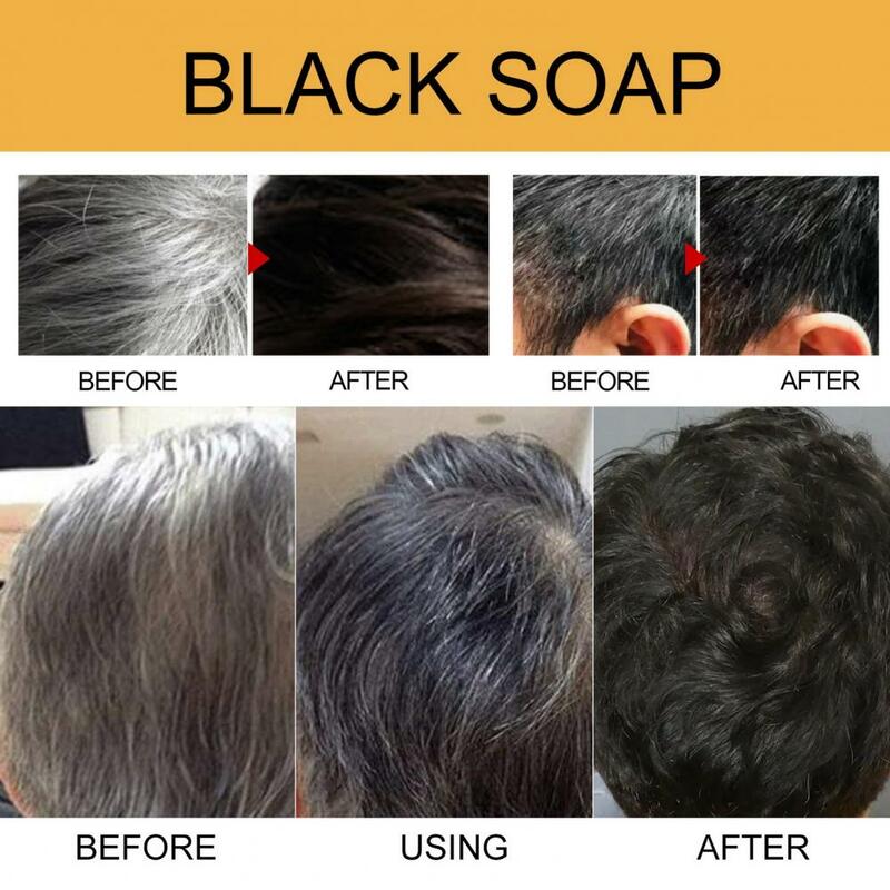 Шампунь для восстановления пигмента волос, мыло для восстановления цвета волос, восстанавливающий шампунь, бар, восстанавливающий рост волос, улучшает кровообращение с серым