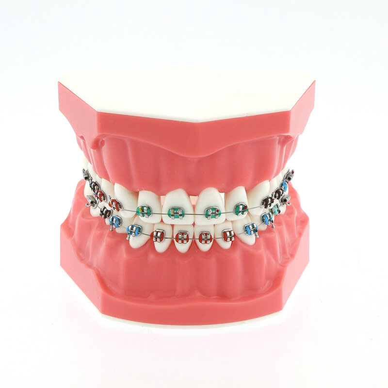 نموذج تقويم الأسنان Typodont مع أقواس معدنية ، دعامة أسنان