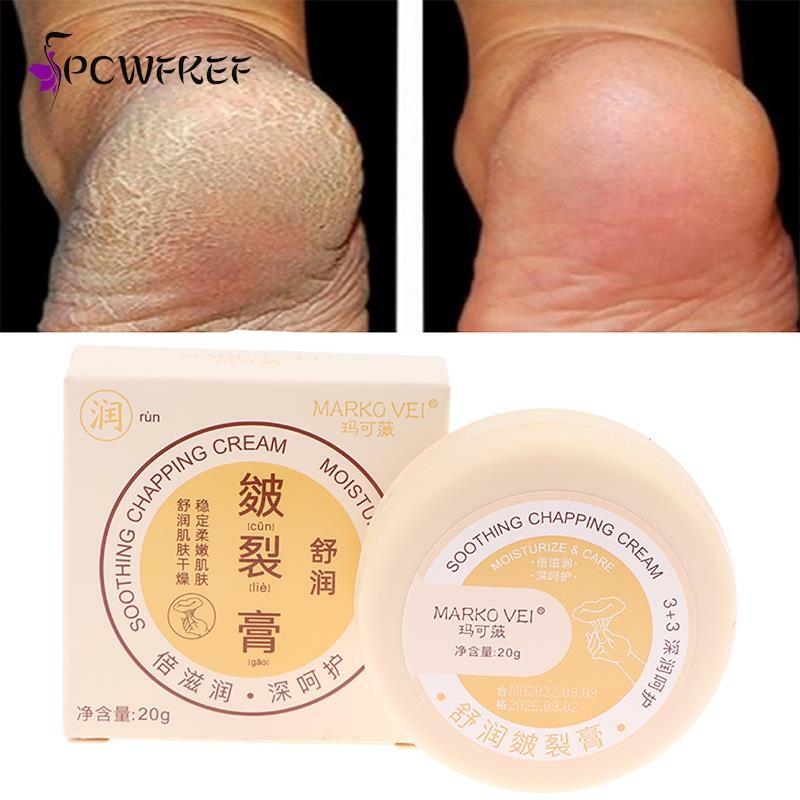 Herbal Anti Cracked Heel Treatment Cream Remoção Anti-Secagem Bálsamo de Pele Morta Calo Reparação Hidratante para Mãos e Pés Máscara de Cuidados com a Pele