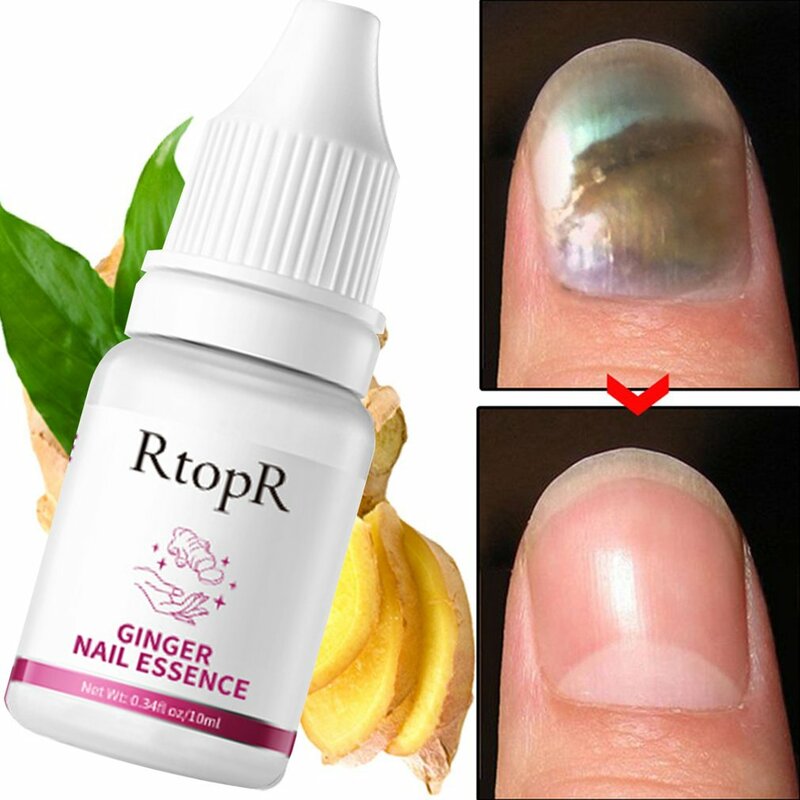 Naprawa paznokci esencja Serum grzybicy paznokci i grzybicy paznokci narzędzia do pielęgnacji skóry