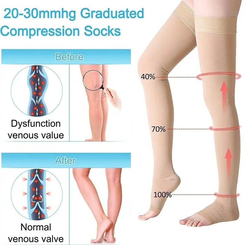 ถุงเท้ากันกระแทกสูงถึงต้นขา1คู่สำหรับผู้หญิงและผู้ชายเปิดนิ้วเท้าถุงน่องรองรับแน่น30-40mmHg บีบอัดสำหรับเส้นเลือดขอด