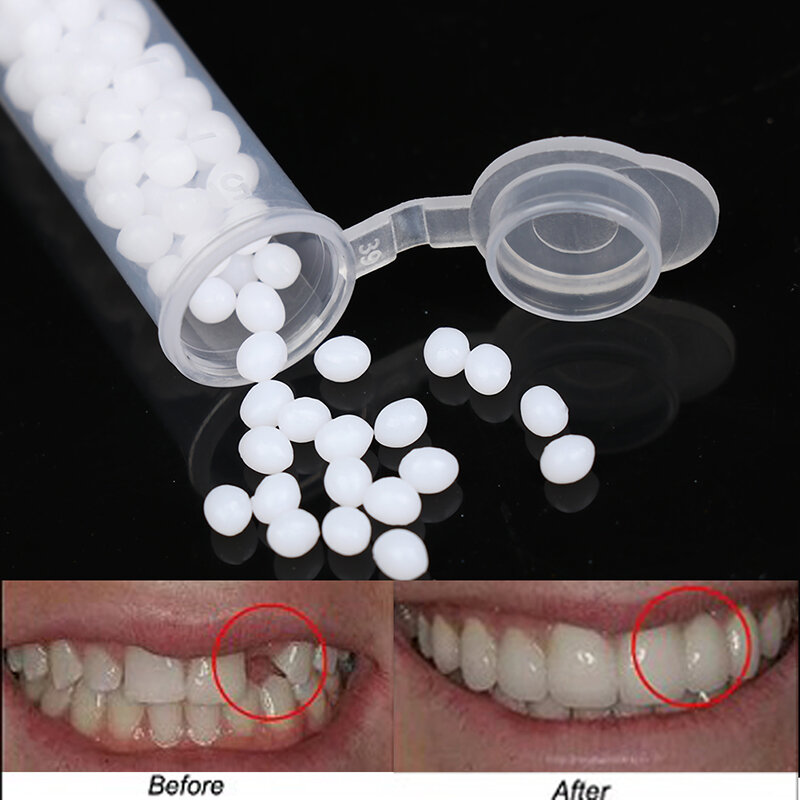 Gigi palsu sementara 1 kotak, peralatan perbaikan gigi dan lubang, lem Solid, perekat pemutih gigi tiruan