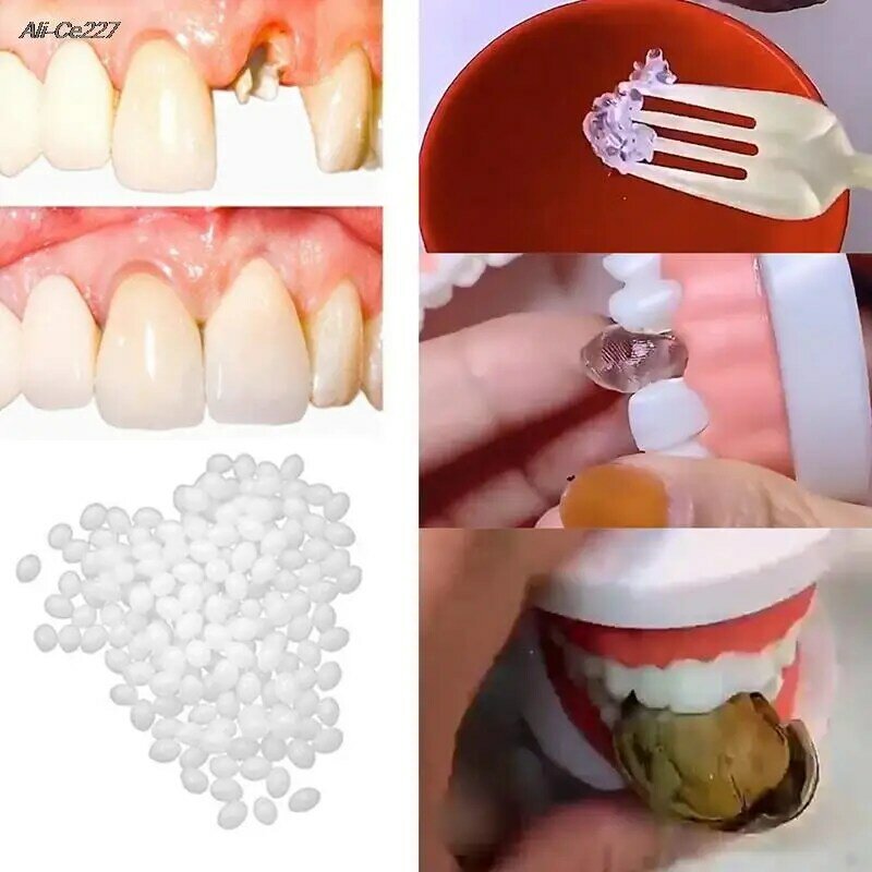 Resina 10g/15g/20g Dente Temporário Kit de Reparação Dentes E Lacunas FalseTeeth Sólidos Cola Dentadura Adesivo Dentes Clareamento Dente Beleza