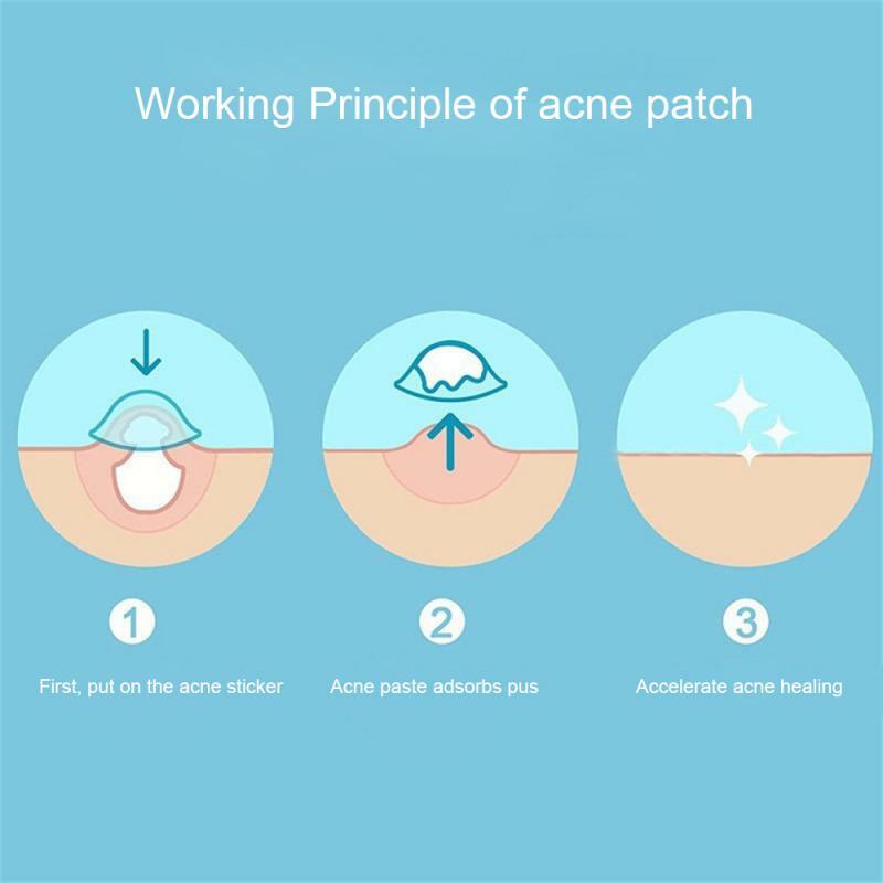 Cozy Acne Patches Absorb Pus Ultra-thin Invisible Acne Patch Acne Products Hydrocolloid Acne Patch Not Easy To Convenient