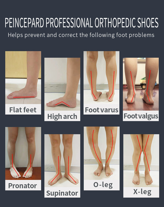 Princepard-zapatos ortopédicos para niños y niñas, Zapatillas altas con punta plana correcta para caminar, cuidado de soporte para ARCO, otoño