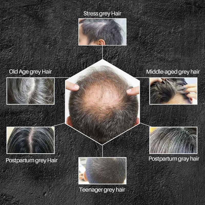 Escurecimento do cabelo Shampoo Bar, Tintura de cabelo, Cinza, Cinza, Branco para Preto, Natural, Gloss, 1 Pc, 35Pcs, 2023