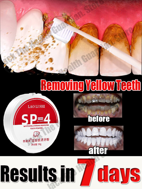 Remover Dental Calculus Whitening Teeth Mouth Odor Removal Bad Breath Preventing Periodontitis