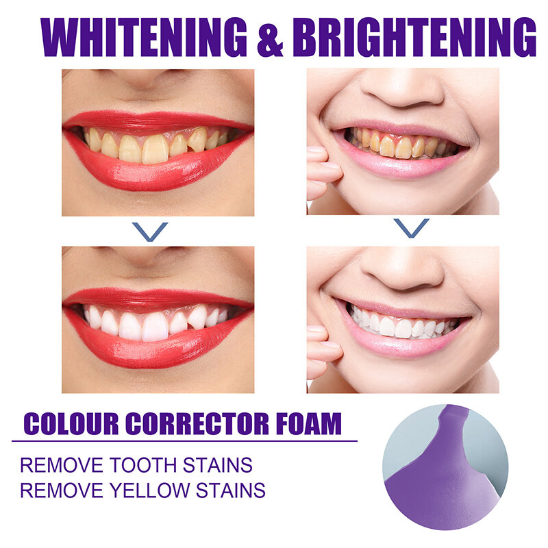 มูส V34ยาสีฟันแก้ไขทำความสะอาดฟันฟอกสีฟันสดใสลดสีเหลืองทำความสะอาดฟันดูแล50มล.
