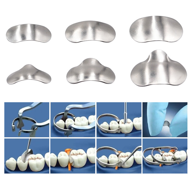 Denspay-Sistema de matriz seccional Dental, banda de matriz seccional Dental, sujeción de resina, anillo separador, herramientas de dentista, 100 piezas