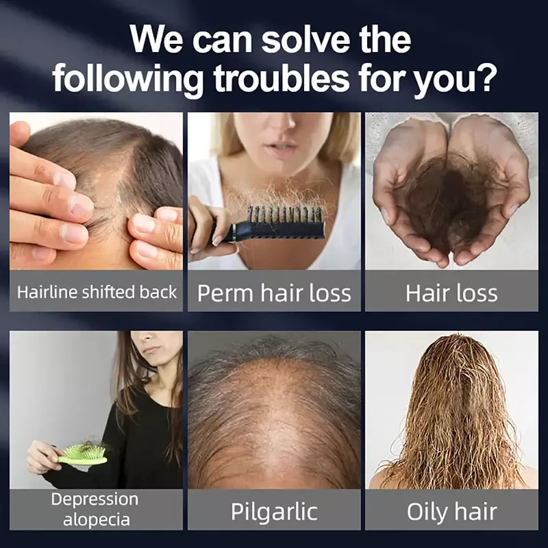Gorro para el crecimiento del cabello, dispositivos de terapia con luz roja LED, tratamiento para la caída del cabello, casco para el crecimiento del cabello, mejora el cuidado del cabello, anticaída