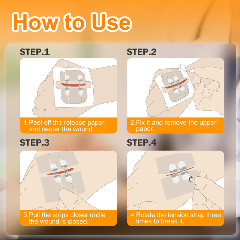 CARBOU-dispositivo de cierre de heridas indoloro con cremallera de 2 piezas, Kit de tiras de cierre de vendaje de heridas sin sutura, cierres de laceración de emergencia