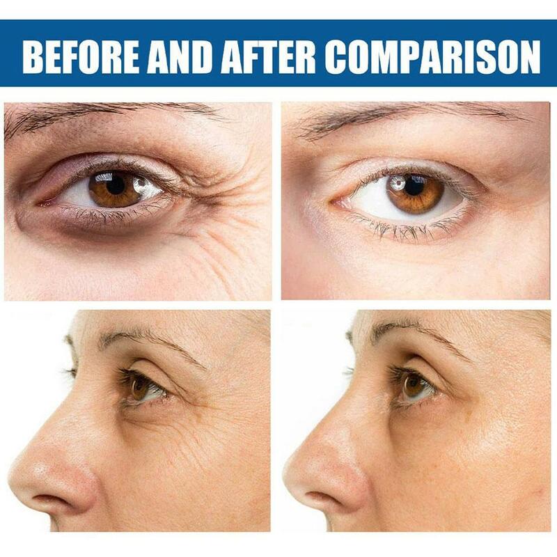 2x Peptide Anti-Wrinkle Eye Cream Collagen Anti Dark Circle Anti-aging Gel Hyaluronic Acid Anti-Puffiness Eye Bags Korea Cosmet