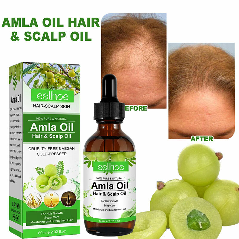 Amla-aceite Original para el crecimiento del cabello, esencia India anticaída, tratamiento del cuero cabelludo, reparación del cabello dañado, 60ml