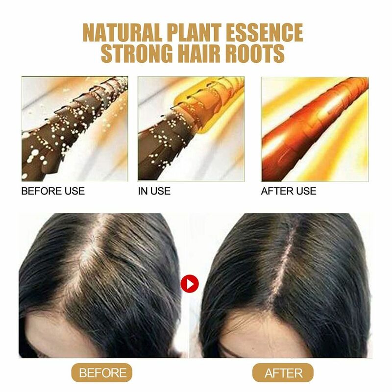 Jabón de jengibre Natural para el crecimiento del cabello para hombres y mujeres, champú anticaída multifuncional, jabón para el crecimiento del cabello