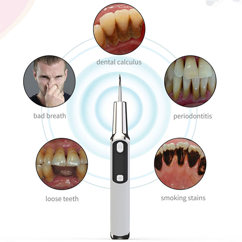 Ultrasonic Tooth Scaler Smart 42KHZ 2MILLION/min LED High-Definition Display USB Charging Remove Calculus/tooth Dirt