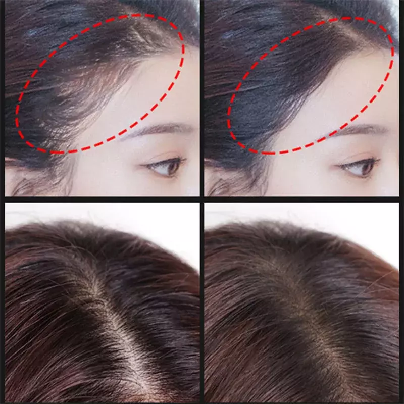 Siero per la crescita dei capelli delle cellule staminali Anti perdita di capelli 28 giorni crescita rapida prevenire il diradamento 2 pz/set essenza per la cura dei capelli
