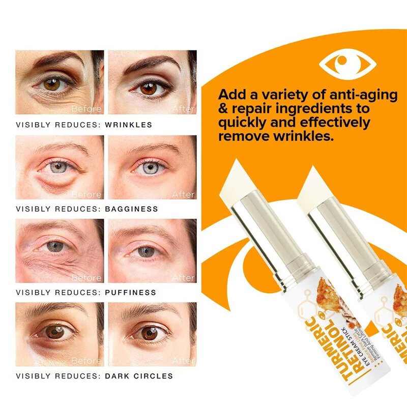Instant Eye Bag entfernen Augen creme Anti-Fett-Partikel Augenringe Schwellungen verblassen feine Linien Lift erhellen koreanische Schönheit Augen pflege