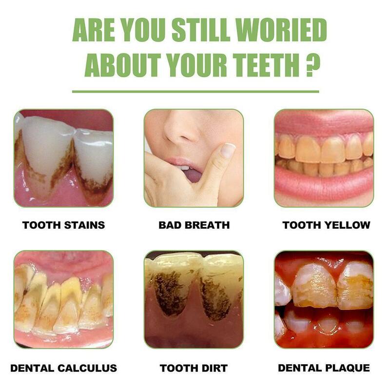 Mpoule dentifricio dente siero fiala essenza dentifricio frutta denti essenza acida sbiancante cura dei denti X2O1