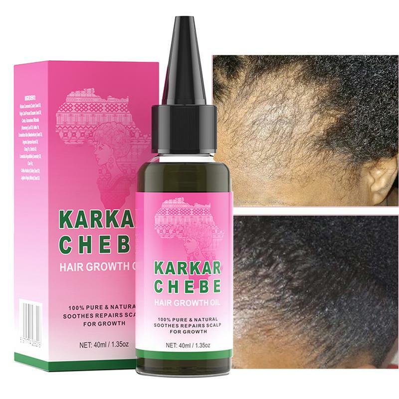 Minyak penumbuh rambut, minyak penguat pertumbuhan rambut, minyak Karkar, Anti rambut rontok, esensi perbaikan rambut Rosemary, minyak esensial rambut