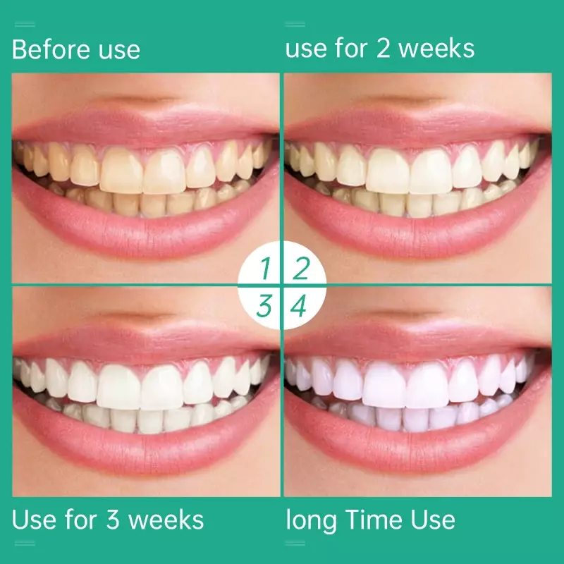 Teeth Brighten Toothpaste Tooth Colour Corrector Enamel Care Toothpaste Intensive Stain Removal Reduce Yellowing Dental Care