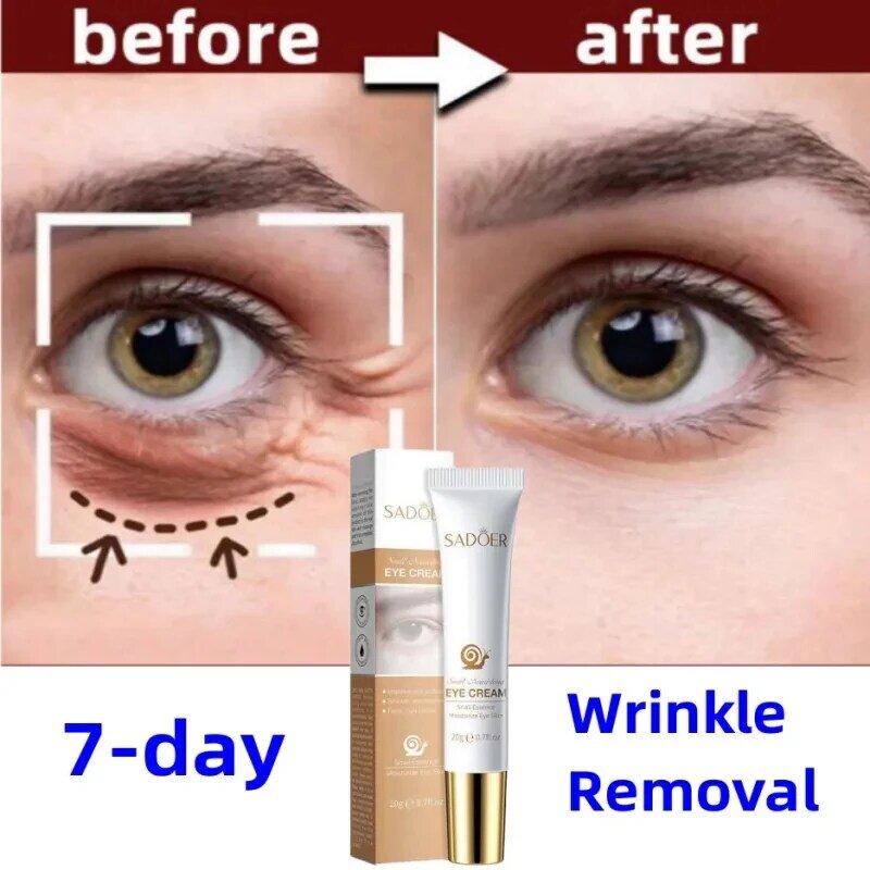 Eye Care Anti-Wrinkle Eye Cream Dark Circles Remove Eye Bags Puffy Reduce Wrinkles Fine Lines Eye Fat Particles Facial Skin Care