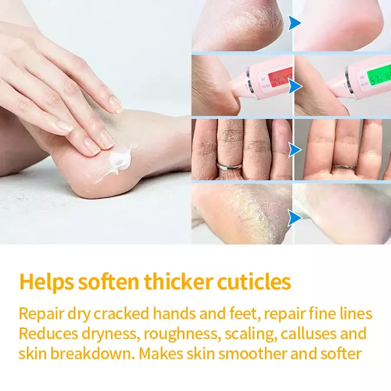 Creme hidratante Anti-crack Pé Máscara emoliente Peeling Secagem Reparar pés rachados Salto de mão Remoção de pele morta Cuidados com os pés