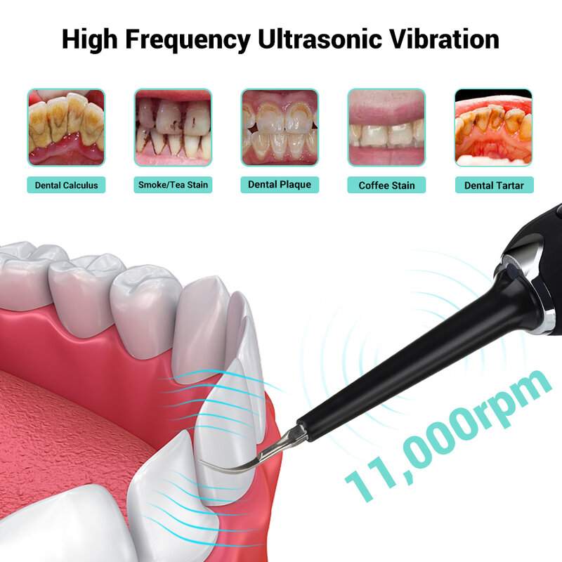 Electric Ultrasonic Vibration Tooth Calculus Remover Sonic Dental Scaler High Frequency Vibration Tooth Stains Teeth Cleaner