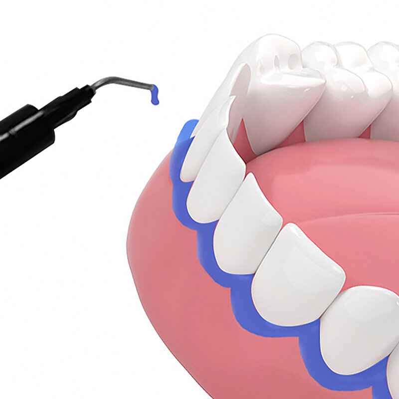 1 szt. Profesjonalny żel wybielający zęby barierę dziąsłową/gumę dentystyczną do wybielania zębów 1.5ml,3ml