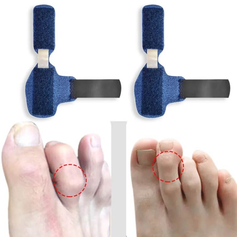 Toe Splint Straightener martelo separador, dedos tortos garra estabilizador, pés cuidados corrector, apoio alívio da dor, 1pc