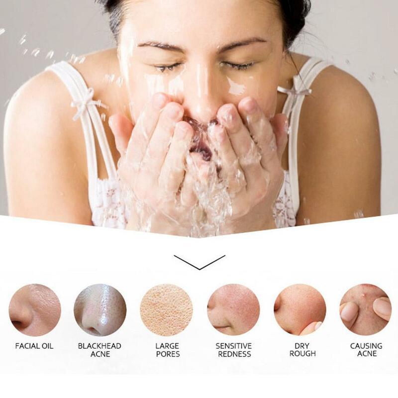 1/2/3PCS Exfoliating Mousse Peeling Gel Face Scrub Deep Remove Skin Types Skin Exfoliator Moisturizing Smooth Cleaning All Cream