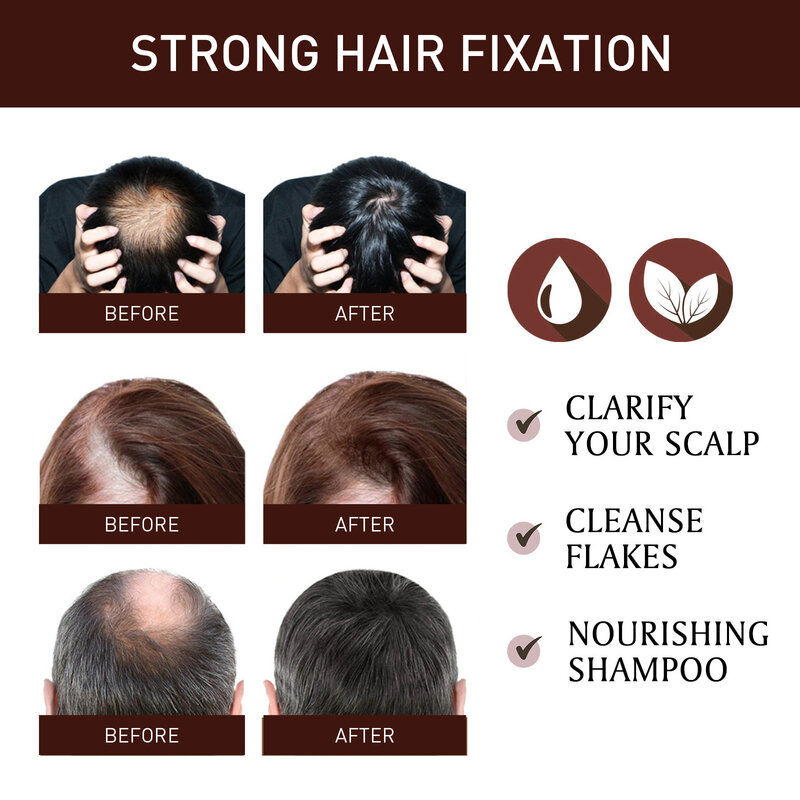 Olio essenziale per la crescita dei capelli al rosmarino stimola i bulbi Anti calvizie efficace denso trattamento del cuoio capelluto oleoso ispessimento diradamento