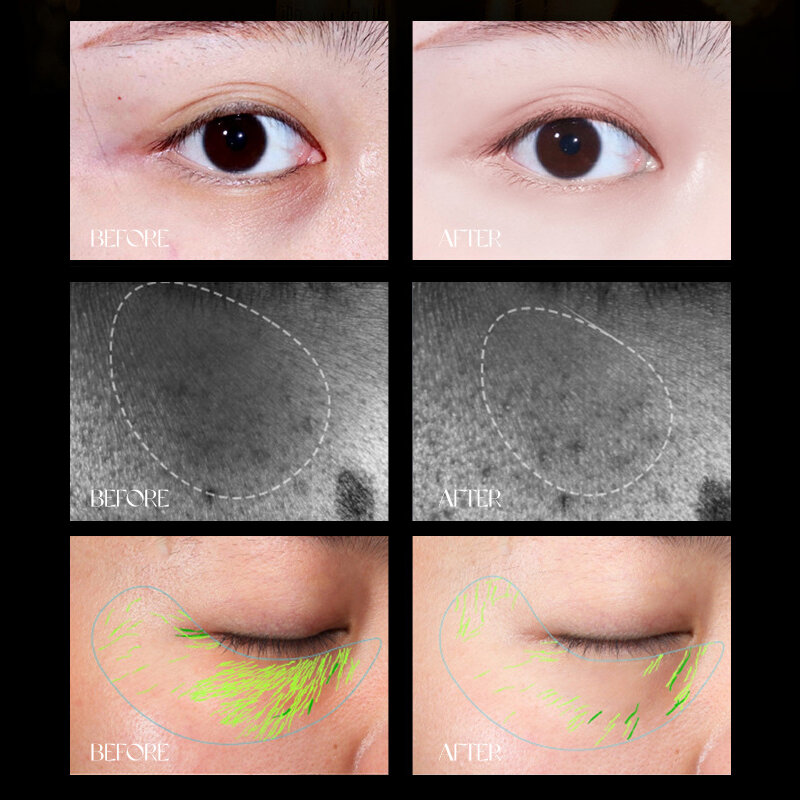 Anti-rugas Eye Cream, Anti-idade, remover círculos escuros, cuidados com os olhos contra o inchaço, bolsas, hidrato, hidratante, reafirmante, reparação, 30g