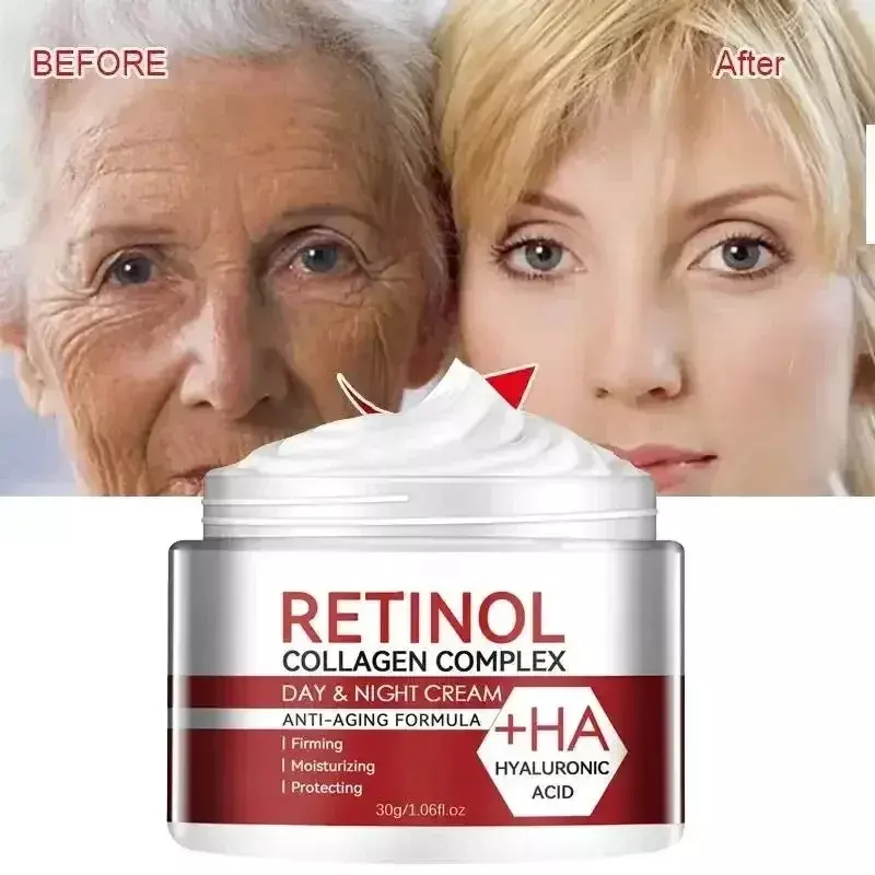 Retinol Falten entfernen Creme Anti-Aging straffen Lifting verblassen feine Linien Bleaching Aufhellung feuchtigkeit spendende Hautpflege Kosmetik