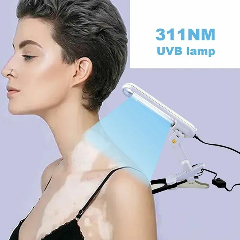 오리지널 UVB 광선 요법, 백반증, 습진, 건선, UVB 램프, 피부 문제 치료 램프, 311nm